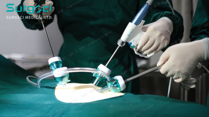 সর্বশেষ কোম্পানির খবর ট্রোকার ছেদ করার স্থান | সার্জসি  0